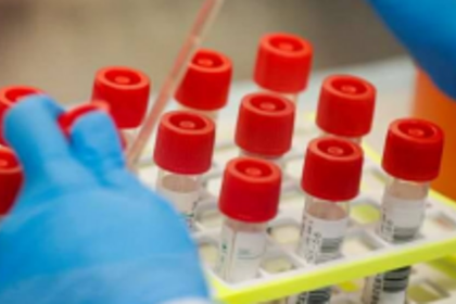 State to get genome sequencing  machine free of cost from US