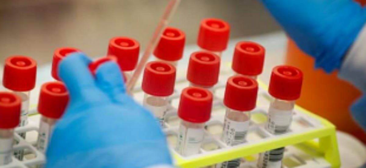 State to get genome sequencing  machine free of cost from US