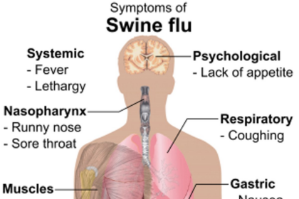 Swine flu health advisory issued