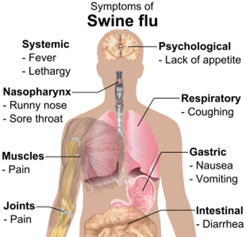 Swine flu health advisory issued