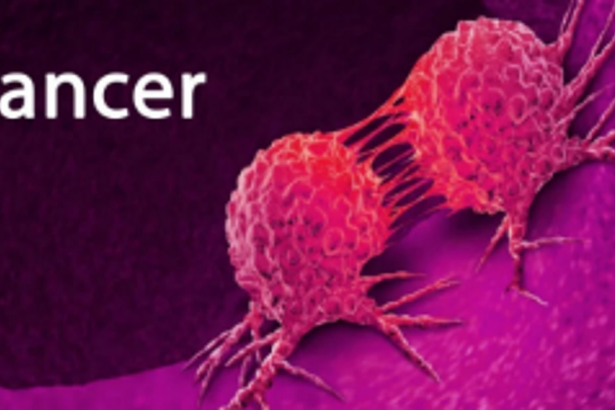 The early diagnosis   of cancer