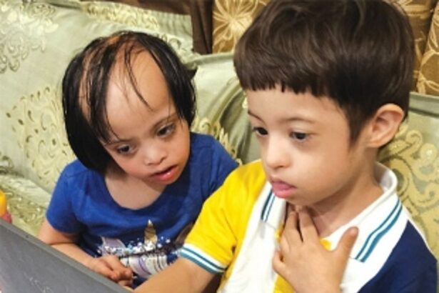 Understanding Down syndrome