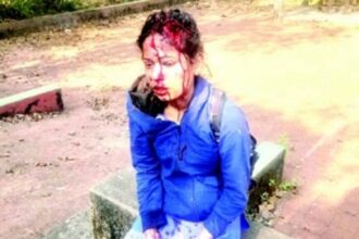 Usgao girl brutally attacked by ‘jilted lover’, left battling for life on V-Day