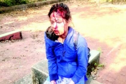 Usgao girl brutally attacked by ‘jilted lover’, left battling for life on V-Day