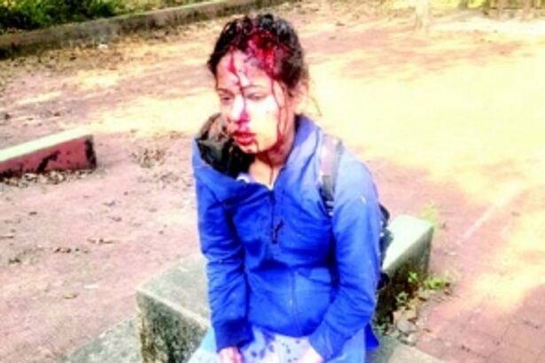 Usgao girl brutally attacked by ‘jilted lover’, left battling for life on V-Day