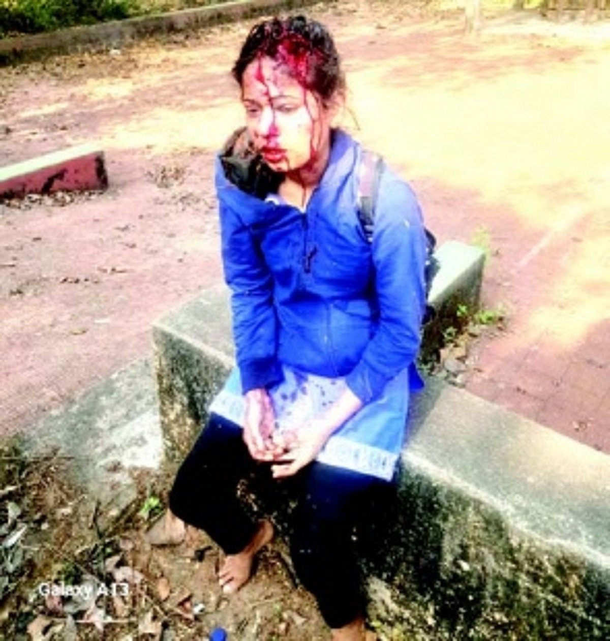 Usgao girl brutally attacked by ‘jilted lover’, left battling for life on V-Day
