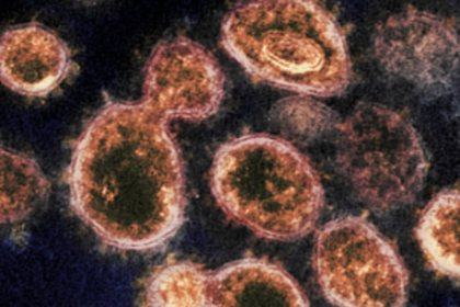 Well done,  but not the time to rejoice; the fight continues