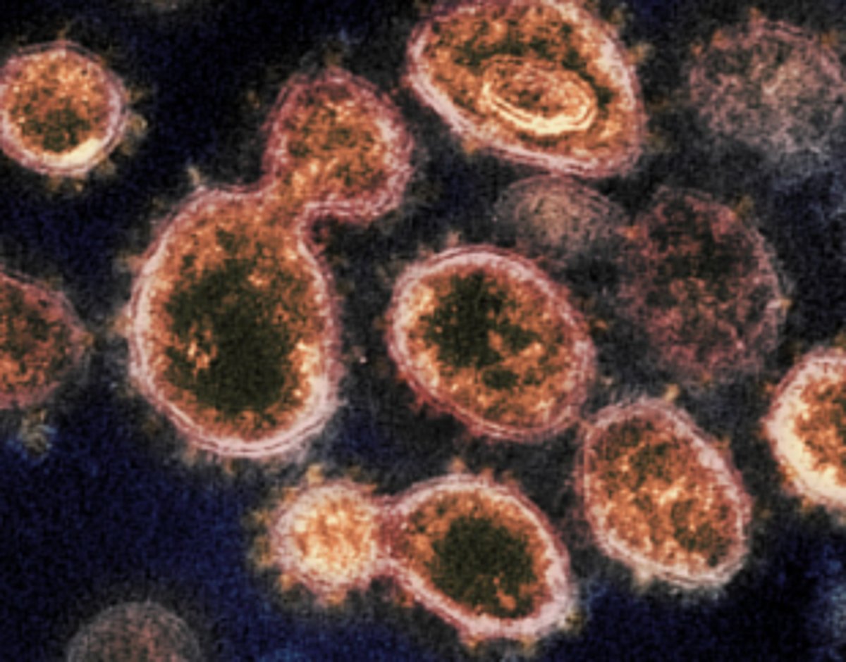 Well done,  but not the time to rejoice; the fight continues