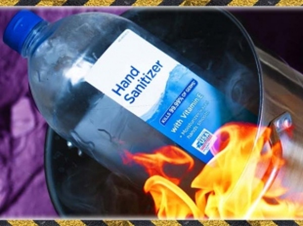 Woman suffers burn injuries