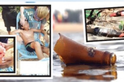 Worst fears come true: Child cuts foot on broken glass piece left on Baga beach