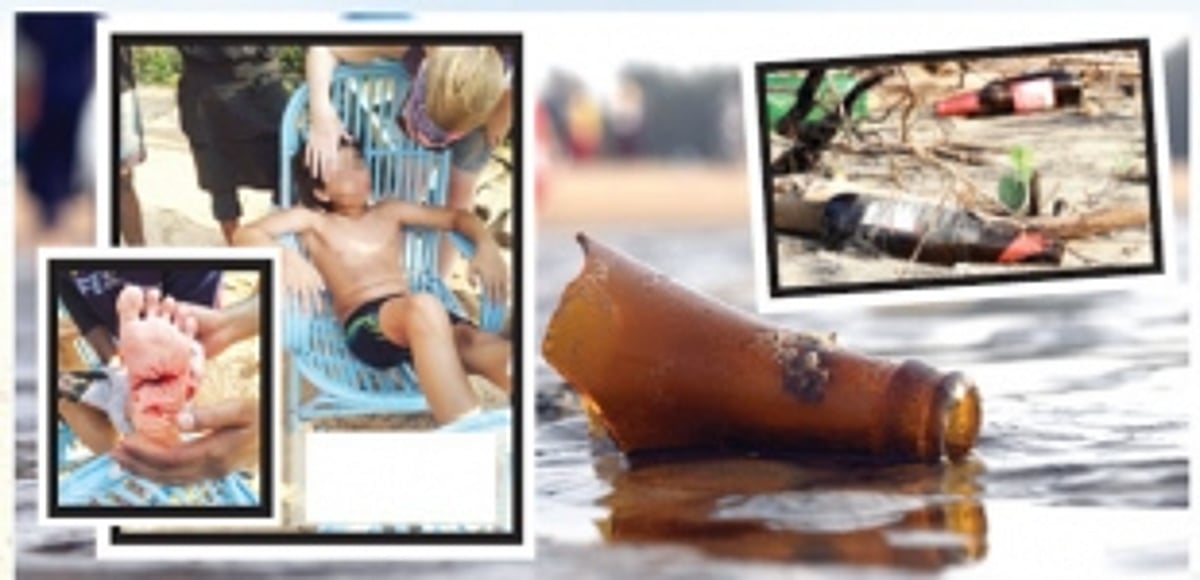 Worst fears come true: Child cuts foot on broken glass piece left on Baga beach