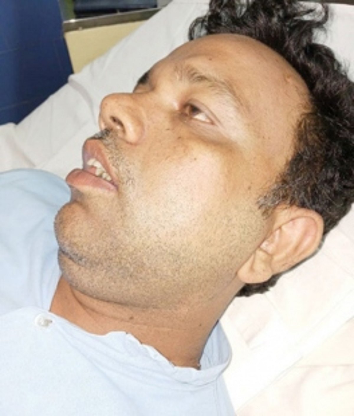 Wounds from an assault by Porvorim cops haven’t healed, as the fight for justice goes on in the corridors of inquiry offices