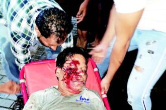 ‘PAVED’ WITH DANGER: Panjim resident smashes his face as scooter falls on exposed paved road