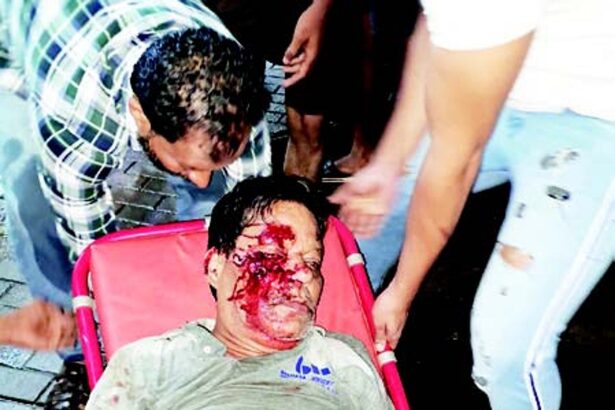 ‘PAVED’ WITH DANGER: Panjim resident smashes his face as scooter falls on exposed paved road