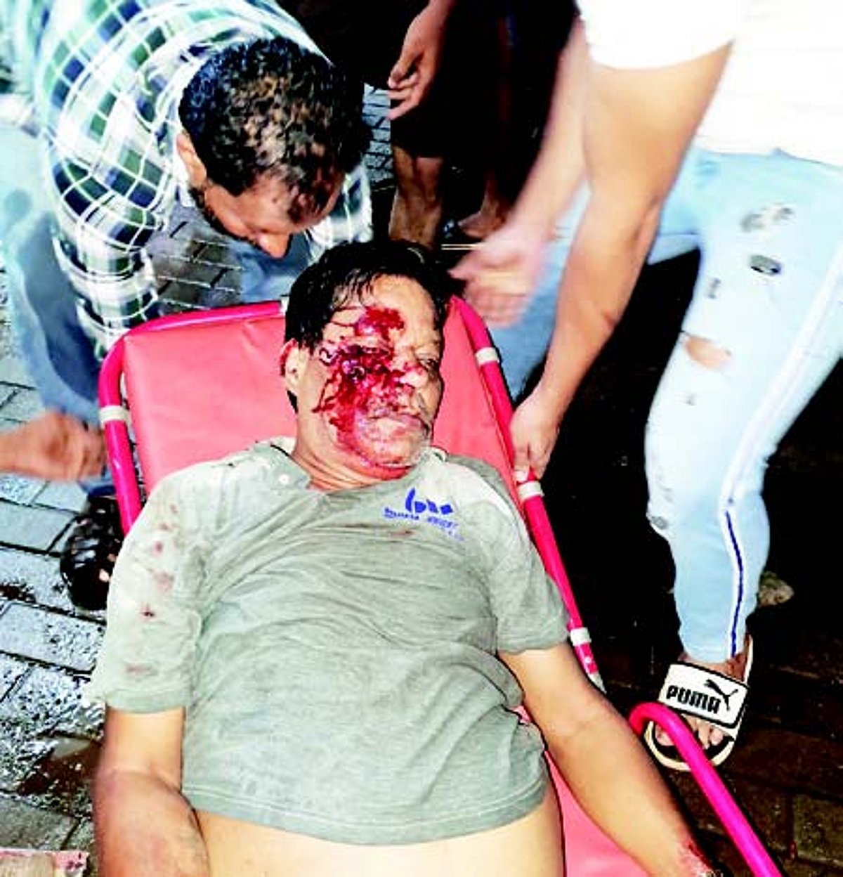 ‘PAVED’ WITH DANGER: Panjim resident smashes his face as scooter falls on exposed paved road