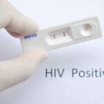 HIV jarun011 scaled 1