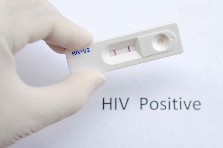 Five children test HIV positive after blood transfusion; Jharkhand CM suspends officials 1 HIV jarun011 scaled 1
