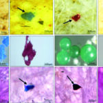 microplastics