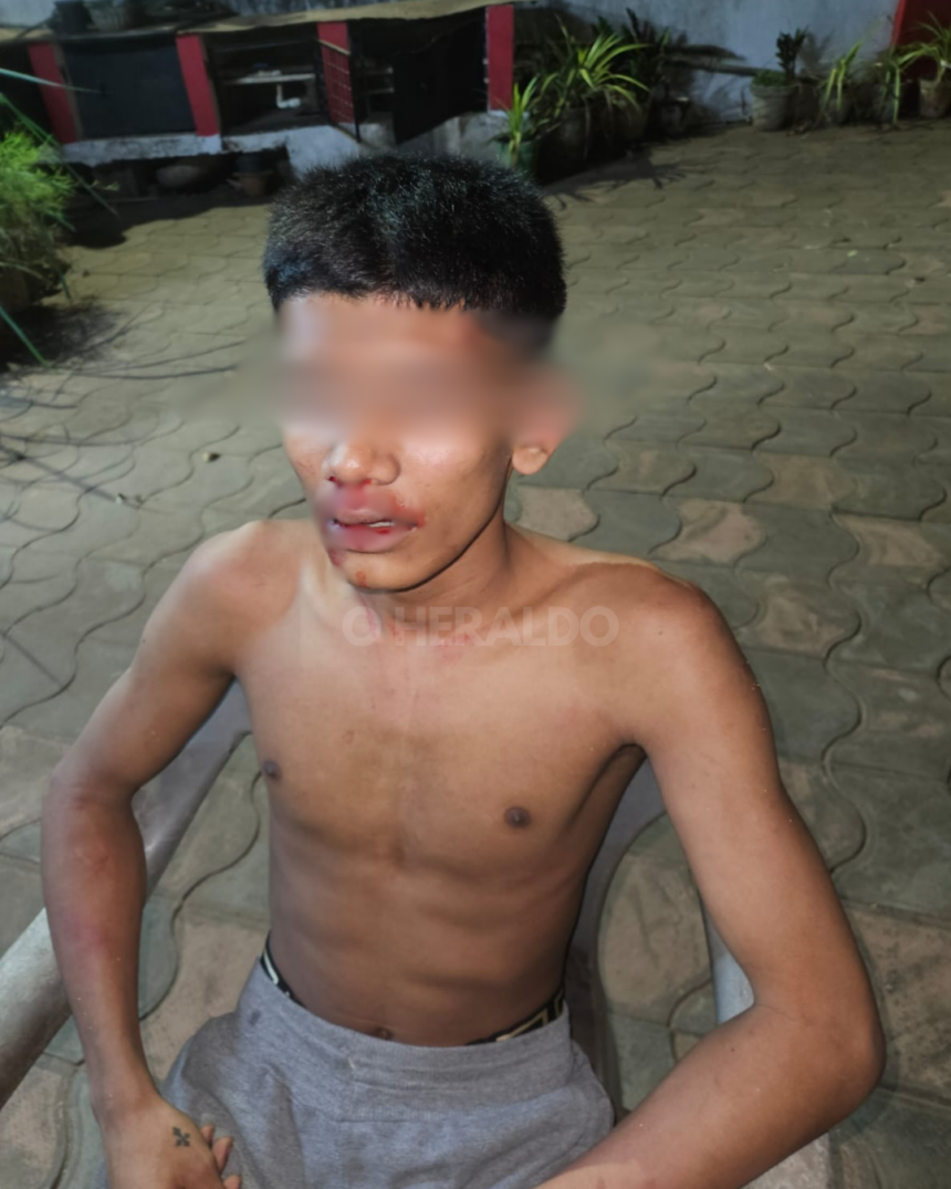 Colva Teen, Woman Assaulted; Threatened Into Silence; Activist Alleges Police Delay in Registering Complaint 1 45 TEMPLATE 2026 04 29T131112.069