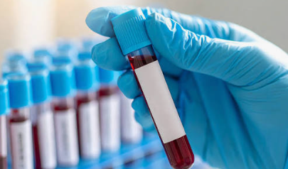Police collect blood samples of victim’s friends 1 Screenshot 2026 04 15 082604