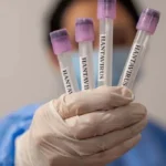 israil de hantavirus vakasi tespit edildi 19825993 6051 amp