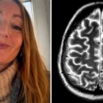 got 38 parasites in brain from india says uk woman 025301213 16x9 0