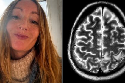 got 38 parasites in brain from india says uk woman 025301213 16x9 0