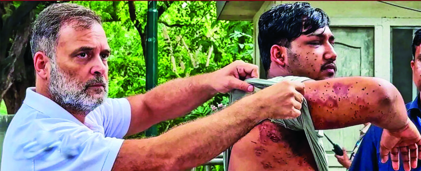 STUDENT PROTEST CRACKDOWN: Who approved pellet guns? Rahul demands answers from Shah 1 pellet
