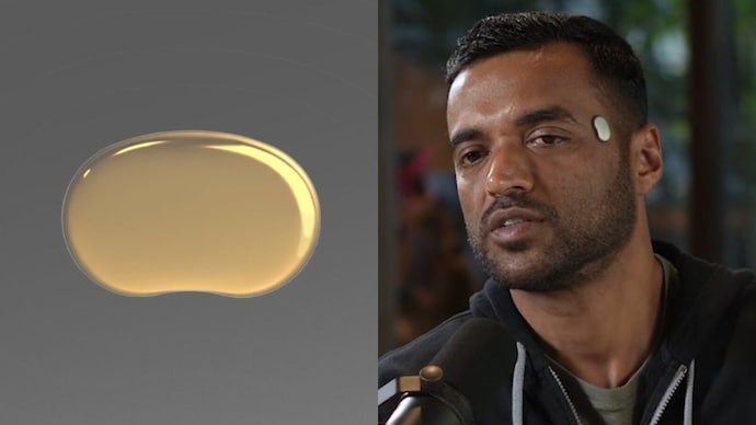 Zomato Founder’s Brain-Tracking Device Shrinks by 50% Ahead of Commercial Release 1 founded by goyal after he stepped down as ceo of eternal temple is developing a forehead worn weara 280023124 16x9 1