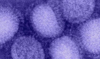 h1n1 influenza virus e1635356243140