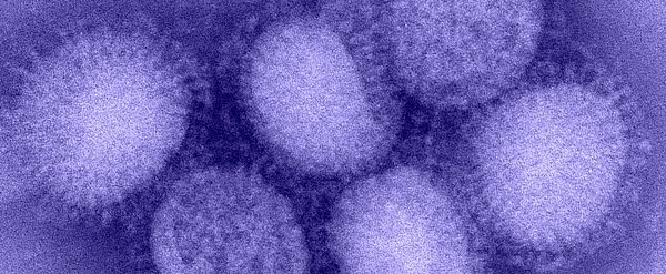 Delhi H1N1 Cases Cross 2,000, Health Minister Says Situation Under Control 1 h1n1 influenza virus e1635356243140